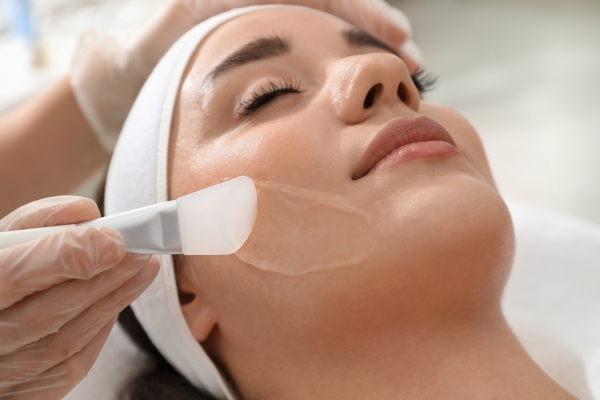 Chemical Peel treatment images